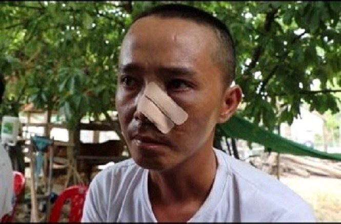 Vụ 3 cha con bị truy sát: Nạn nhân kể lại vụ việc - ảnh 1