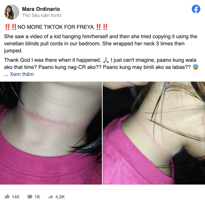 Bé gái 4 tuổi ở Philippines suýt mất mạng khi thực hiện theo thử thách treo cổ trên TikTok - ảnh 1