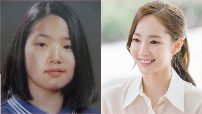 Sự thật gây sốc về bức ảnh Park Min Young trước khi thẩm mỹ: Có hiểu nhầm không hề nhẹ - ảnh 2
