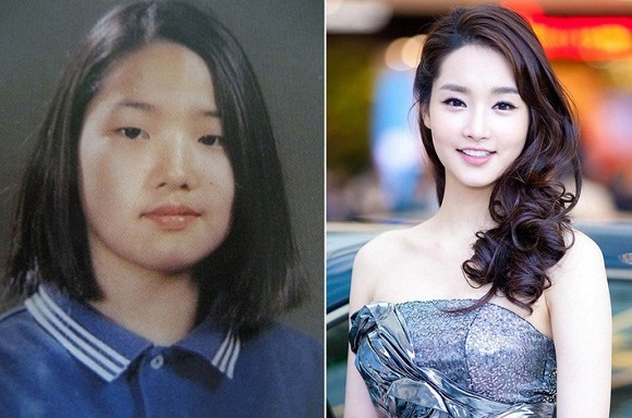 Sự thật gây sốc về bức ảnh Park Min Young trước khi thẩm mỹ: Có hiểu nhầm không hề nhẹ - ảnh 5