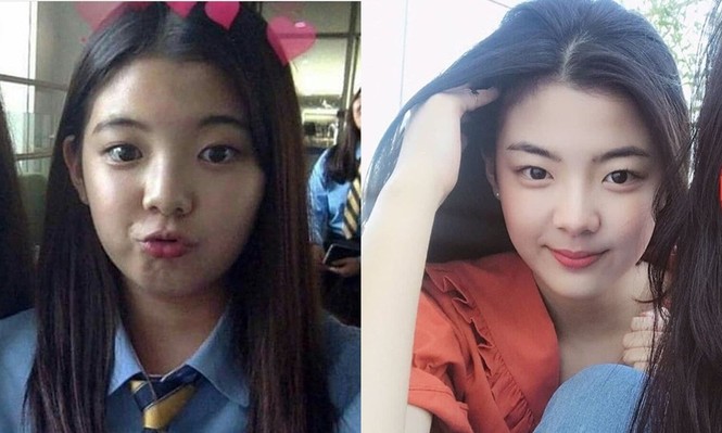 Từ giảm cân thành công, Lia (ITZY) ngày càng gầy thêm và có nguy cơ giảm cân quá đà - ảnh 1