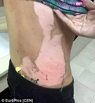Cãi nhau với bồi bàn, cô gái bị dội nước sôi lên đầu - ảnh 2