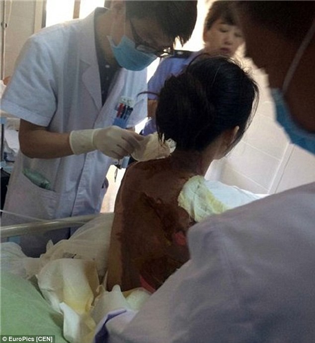 Cãi nhau với bồi bàn, cô gái bị dội nước sôi lên đầu - ảnh 5