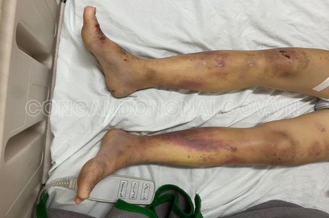 Chủ quán hành hạ nữ nhân viên như thời trung cổ vì không chịu kích dục cho khách - ảnh 1