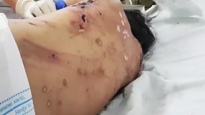Chủ quán hành hạ nữ nhân viên như thời trung cổ vì không chịu kích dục cho khách - ảnh 2
