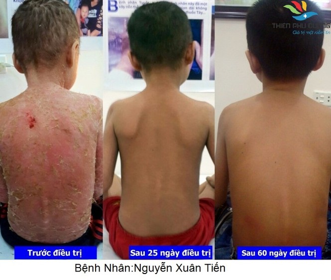 Hạnh phúc của mẹ là khi con yêu được khỏe mạnh - ảnh 2