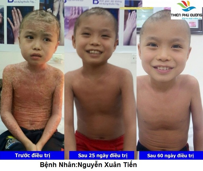 Hạnh phúc của mẹ là khi con yêu được khỏe mạnh - ảnh 1