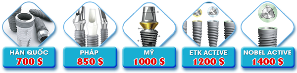 Trồng răng cấm giá bao nhiêu là chuẩn nhất? - ảnh 3