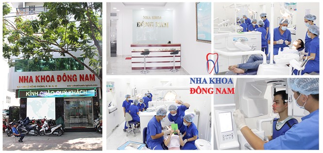 Trồng răng cấm giá bao nhiêu là chuẩn nhất? - ảnh 4