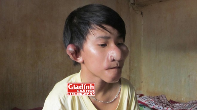 Cuộc sống cơ cực của cậu bé “Trư Bát Giới” bị cha bỏ rơi - ảnh 3