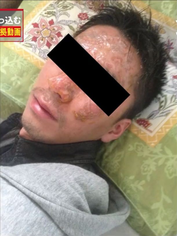 SỐC: Giám đốc giải trí dúi mặt nhân viên vào nồi lẩu sôi để... pha trò - ảnh 3