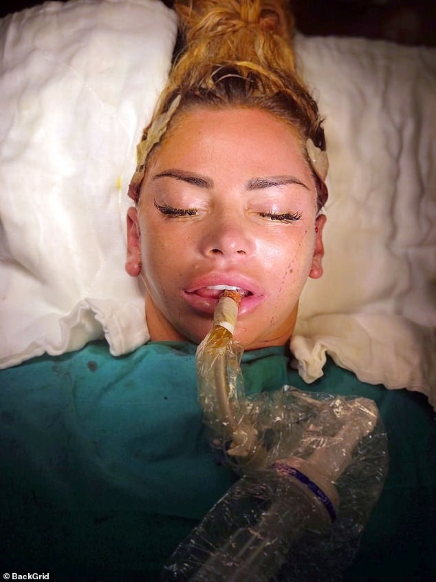 Hãi hùng gương mặt sưng phồng, biến dạng vì ‘dao kéo’ của Katie Price - ảnh 2
