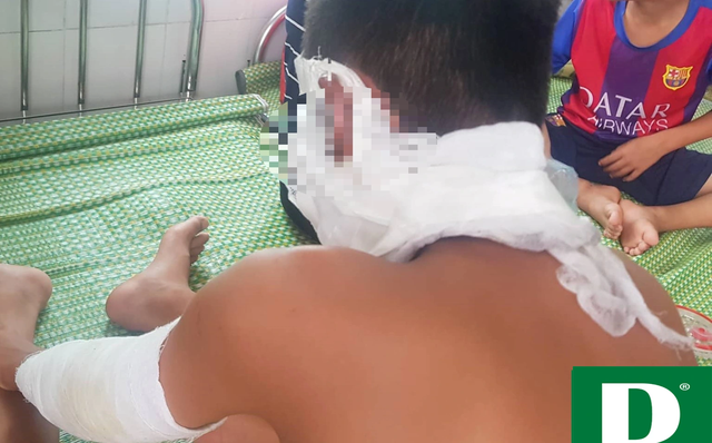 Chùm bóng bay phát nổ, 3 cầu thủ U14 Sông Lam Nghệ An nhập viện - ảnh 3