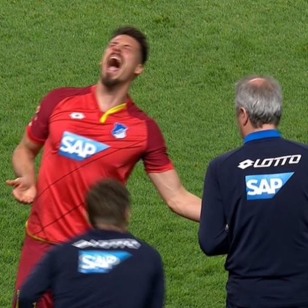 Kinh hãi với ngón tay bị gãy của sao Bundesliga - ảnh 1