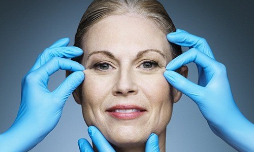 botox - ảnh 1