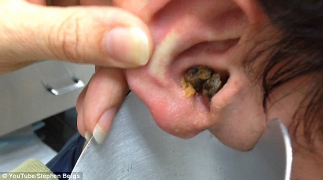 Tại sao bạn bị ngứa tai và làm thế nào để điều trị nó? - ảnh 2
