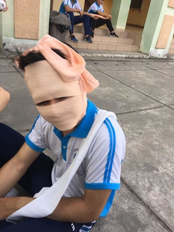 Loạt ảnh
