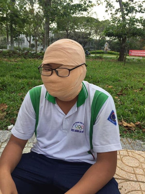 Loạt ảnh