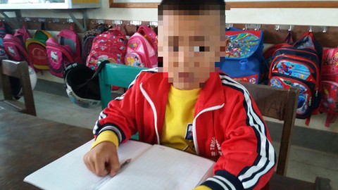Quảng Bình: Học sinh lớp 1 bị tát phải nhập viện
