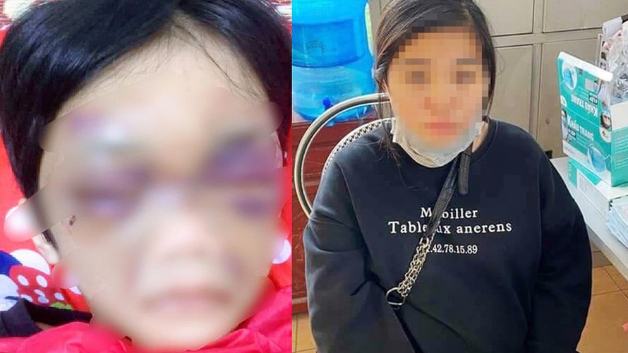 Điều tra vụ bé gái 6 tuổi ở Hải Dương bị mẹ bạo hành phải nhập viện