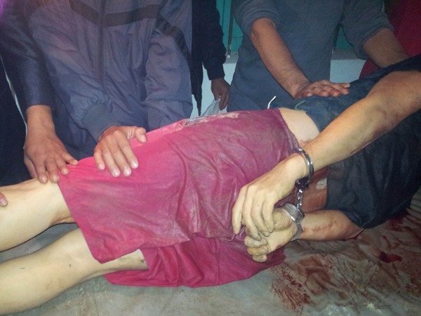 Nạn nhân Bùi Văn Lợi sau khi bị trúng đạn, tử vong tại bệnh viện vẫn trong tình trạng bị còng tay