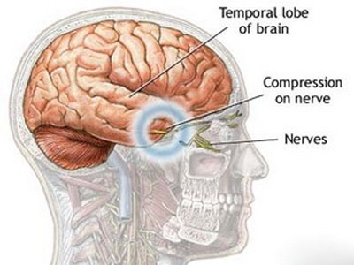 Hình ảnh não người. (Nguồn: Internet)
