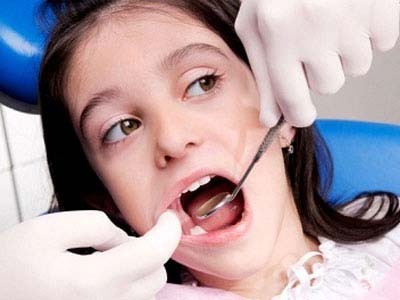 Trẻ xỉn đen cả hàm răng vì viêm tủy