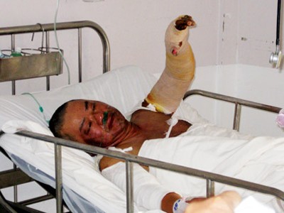 Nhà báo Hoàng Hùng lúc còn điều trị tại Bệnh viện Chợ Rẫy (ảnh chụp ngày 20-1)