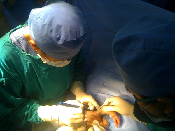Các bác sĩ đang phẫu thuật bóc tách 2 cánh tay thừa cho bé Luyền. Ảnh: L.N