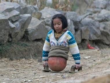 Rơi lệ nhìn cô gái không chân đi bằng bóng rổ