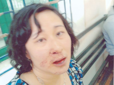 Bà Trần Thị Giang sau khi bị hành hung (ảnh nhân vật cung cấp)