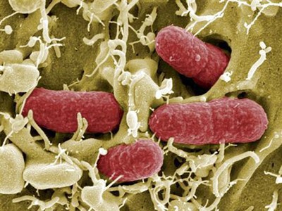 Khuẩn E.coli chủng mới khiến 24 người tử vong Ảnh: Reuters