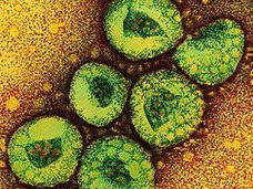 WHO: Phát hiện virus mới có khả năng lây từ người sang người