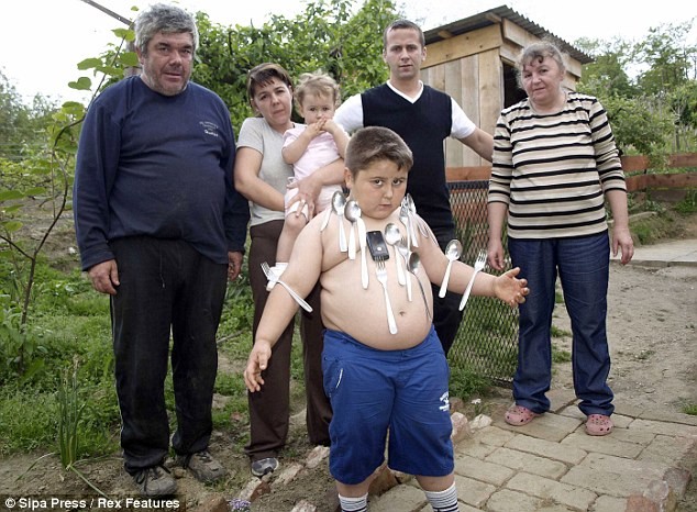 “Người nam châm” 6 tuổi hút được 25 kg kim loại