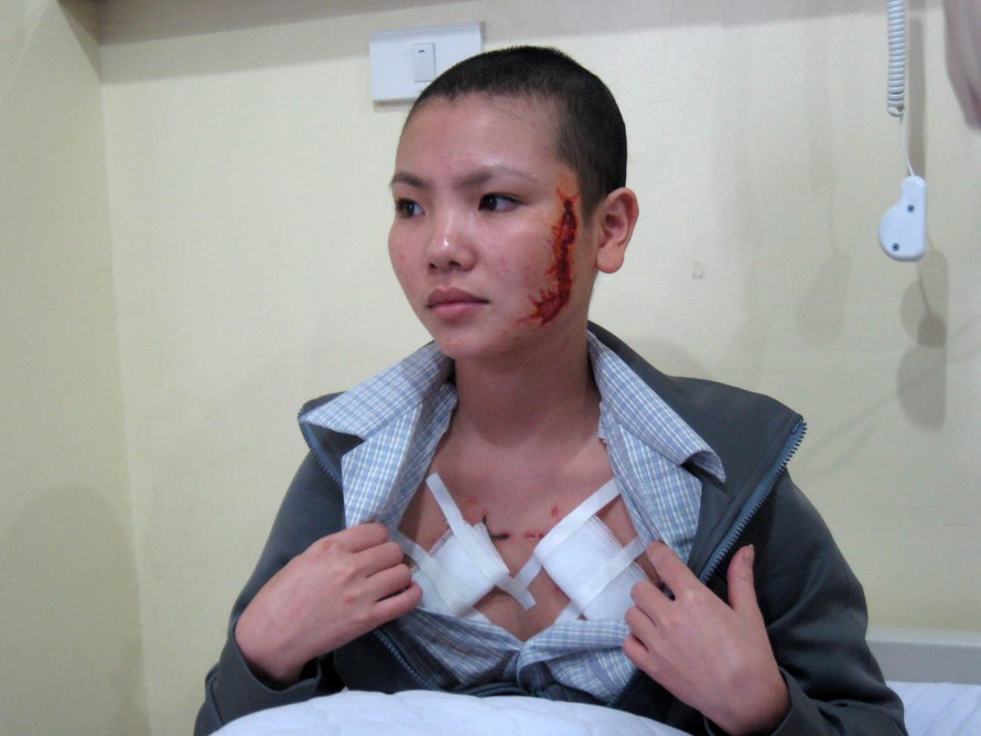 Nguyễn Thị Giang tại Bệnh viện Đa khoa Thu Cúc hôm qua (18-12)