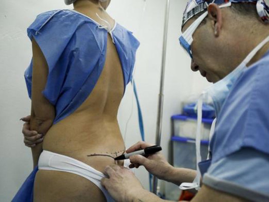 Hối hận ‘dao kéo’, phụ nữ Venezuela đổ xô phẫu thuật bỏ silicon