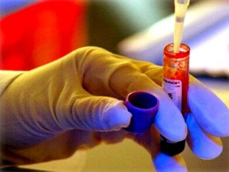 Bắt buộc một số đối tượng phải xét nghiệm HIV