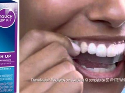 Bỏng môi, sưng lợi vì miếng dán trắng răng siêu tốc