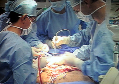 Phẫu thuật cho bệnh nhân có khối U 90 kg