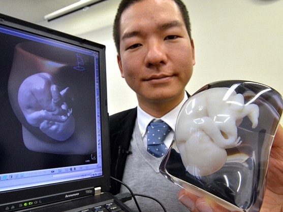 In hình bào thai bằng công nghệ 3D ở Nhật Bản
