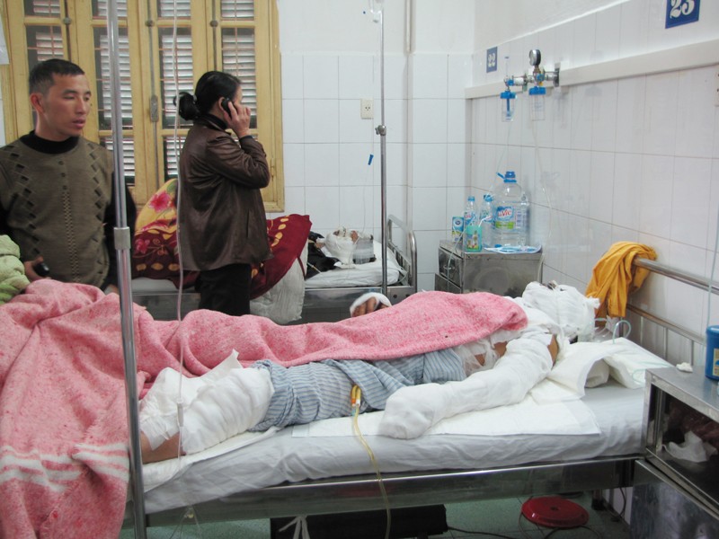 Anh Nguyễn Huy Việt,chủ cửa hàng gas Phú Vinh, bị bỏng 60%, đang nằm điều trị tại Bệnh viện Xanh Pôn. Ảnh: Tuấn Nguyễn