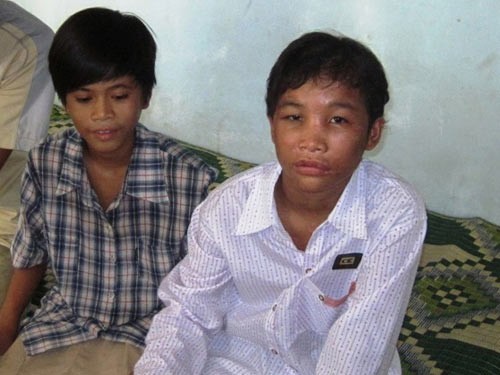 Cháu Hào Anh (phải) vẫn khỏe mạnh và đang học tập tốt tại Trung tâm Bảo trợ xã hội tỉnh Cà Mau. Ảnh: Người Lao Động