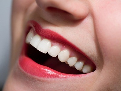 Bí mật giúp bạn có hàm răng trắng bóng hơn