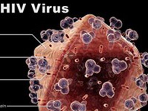 Cảnh báo chủng virus HIV mạnh hơn