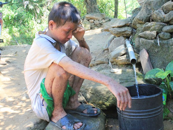 Bệnh nhân Phạm Văn Trách dù sức khỏe rất yếu vẫn cố gắng lấy nước suối về sinh hoạt -Ảnh: PHÚC LONG