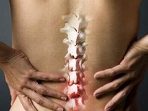 Cách điều trị đau cột sống thắt lưng