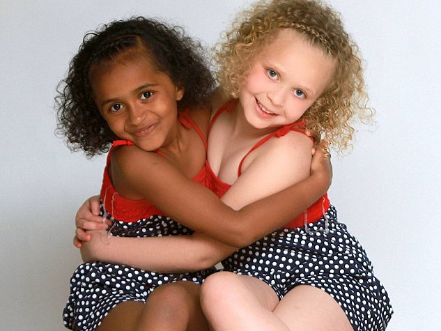 Kì lạ hai bé gái sinh đôi khác màu da