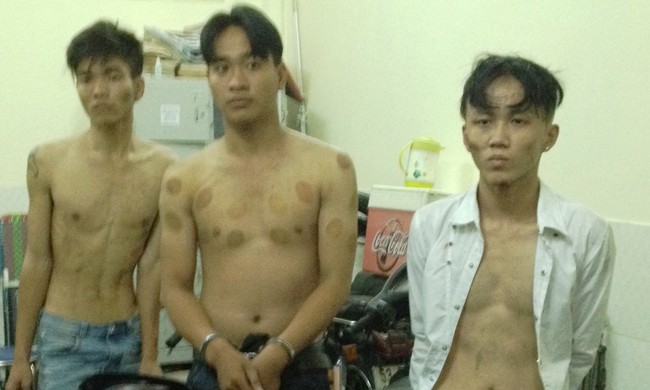 Đặc nhiệm hạ gục ba tên cướp giật táo tợn giữa đường phố Sài Gòn