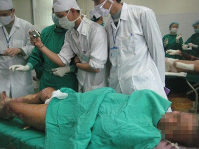 Bệnh nhân Nguyễn Sĩ Hợi chuẩn bị được phẫu thuật cắt lọc hoại tử