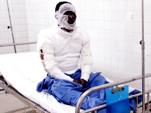 Đà Nẵng: Đôi tình nhân bị tạt a xít bỏng nặng